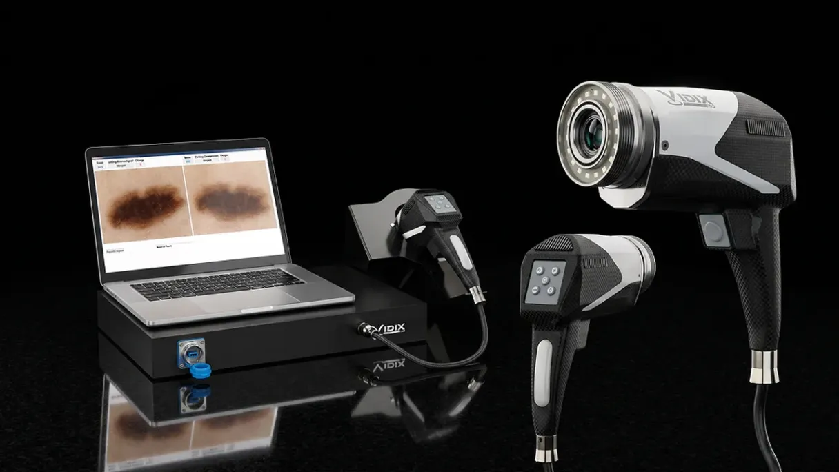 Sistema Canfield Scientific con laptop e tre videocamere digitali per dermatoscopia